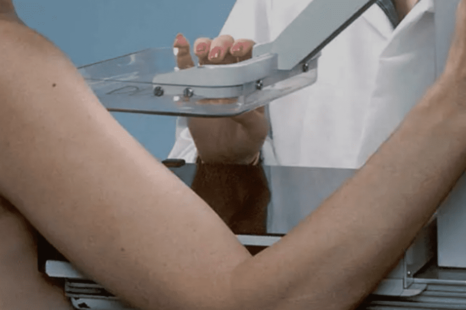 δωρεάν μαστογραφία