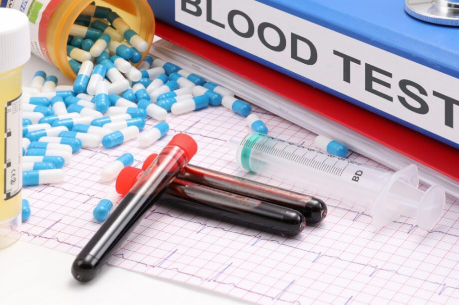 εξετάσεις αίματος