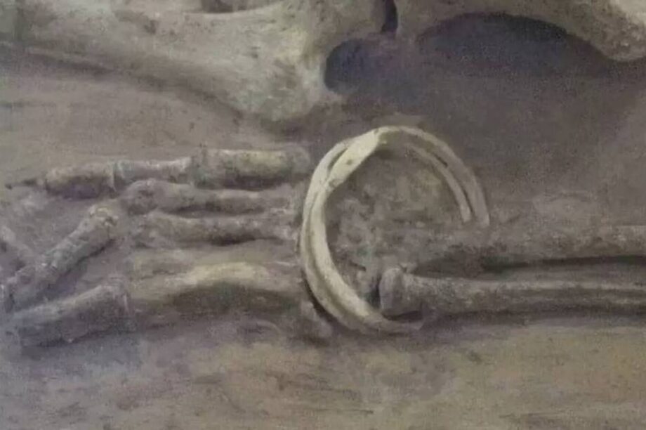 Ραδιενεργοί σκελετοί