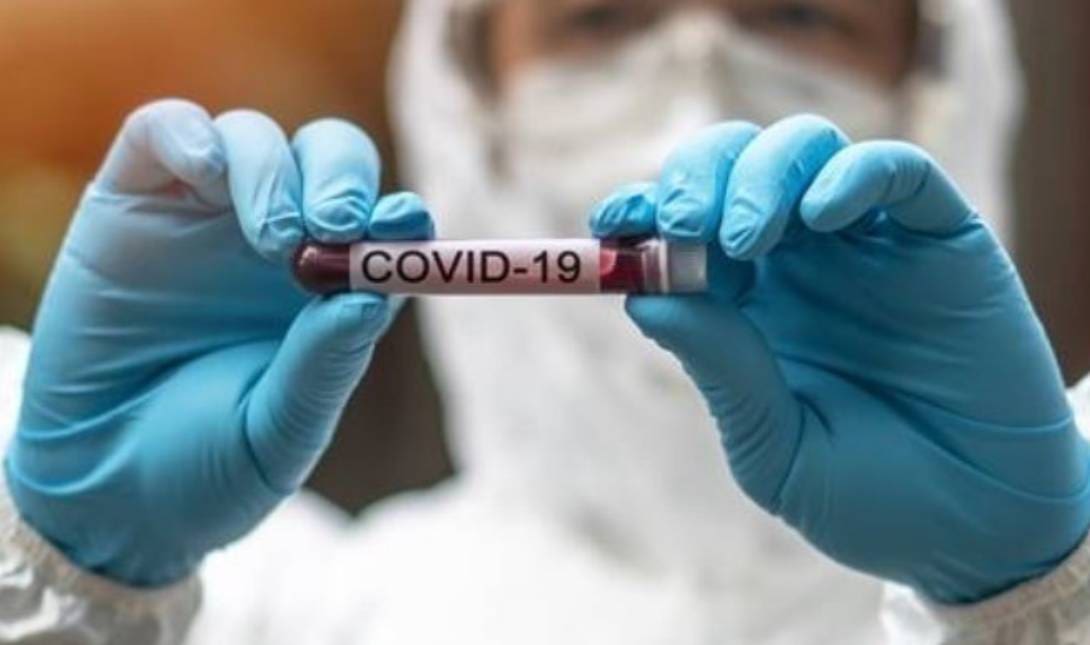Covid 19