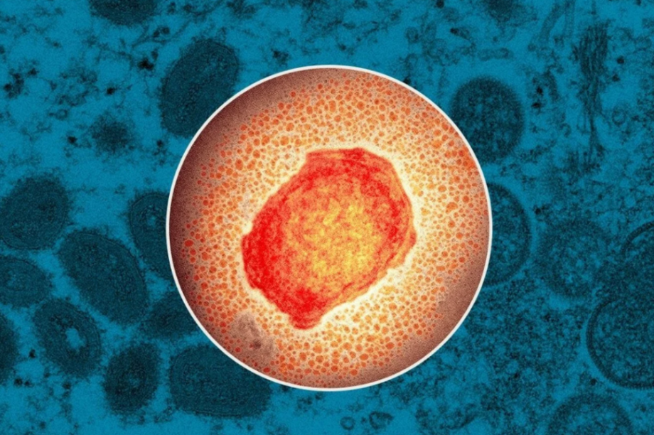 ευλογιά πιθήκων