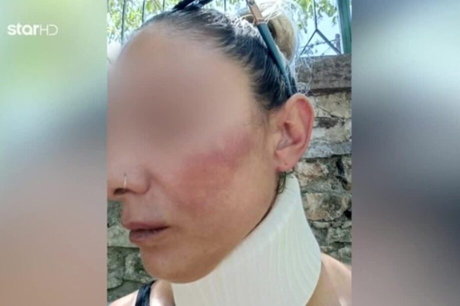 Λέσβος ενδοοικογενειακή βία ξυλοδαρμός