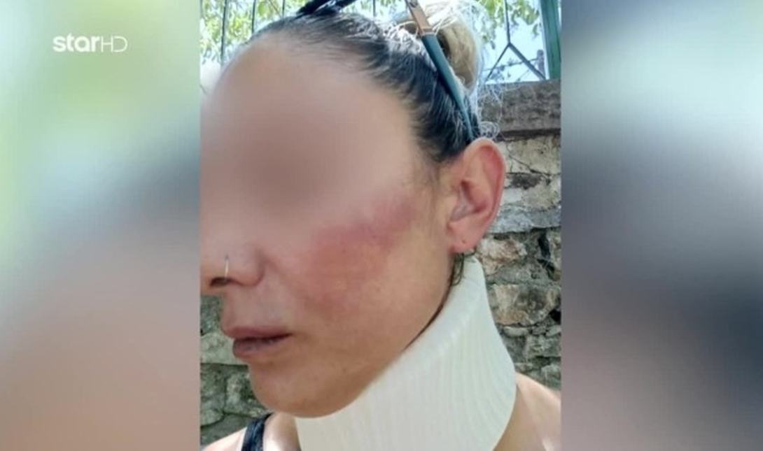 Λέσβος ενδοοικογενειακή βία ξυλοδαρμός