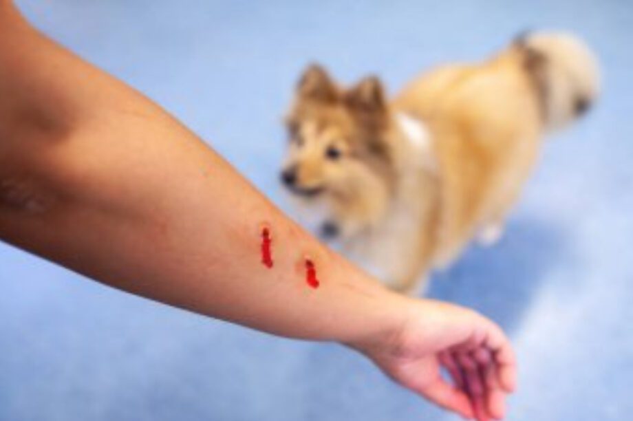 επίθεση σκύλος