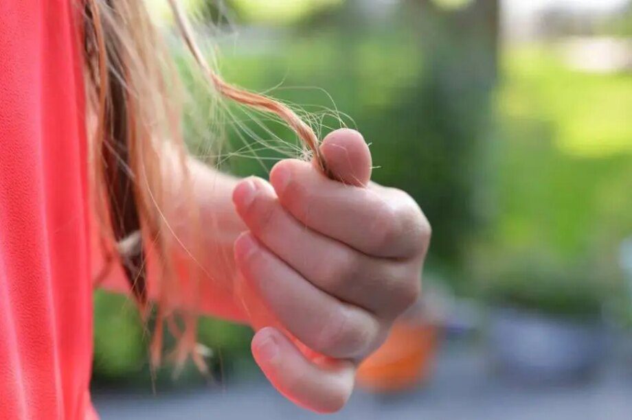 τριχόπτωση