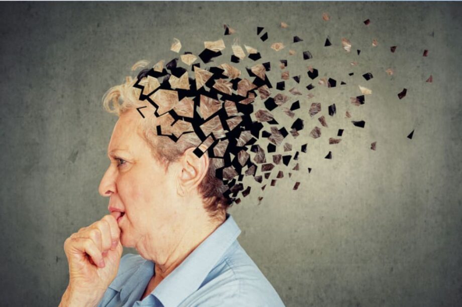 Αλτσχάιμερ