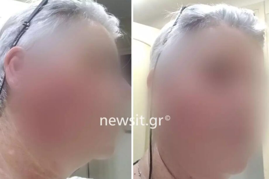 Χαλκίδα κακοποίηση