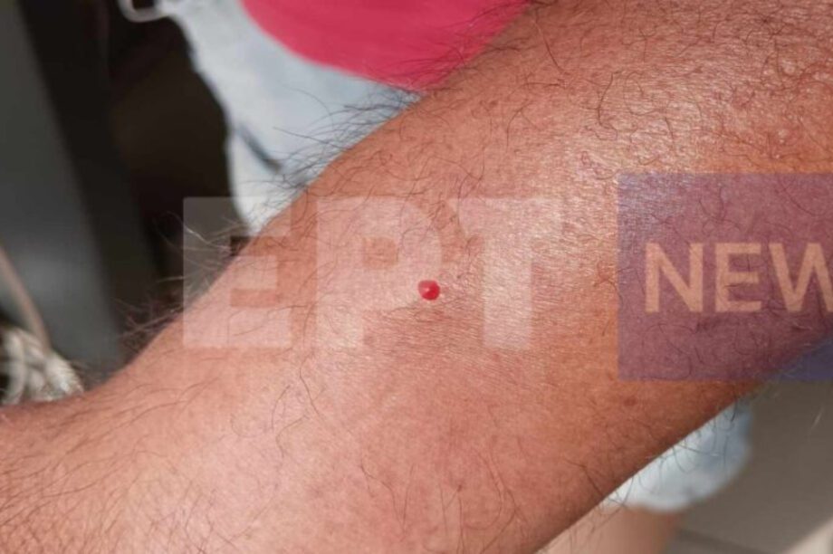 Χανιά λεοντόψαρο