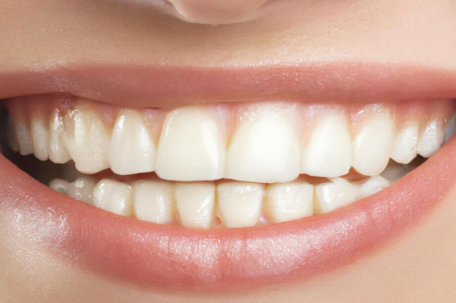 Δόντια χαμόγελο