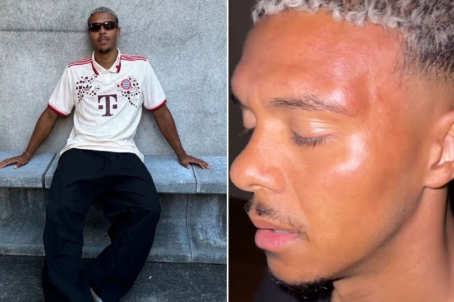 ποδοσφαιριστής ξυλοδαρμός