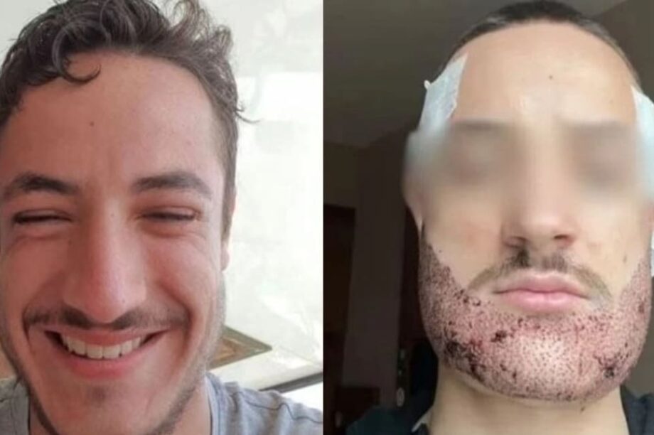 αυτοκτονία