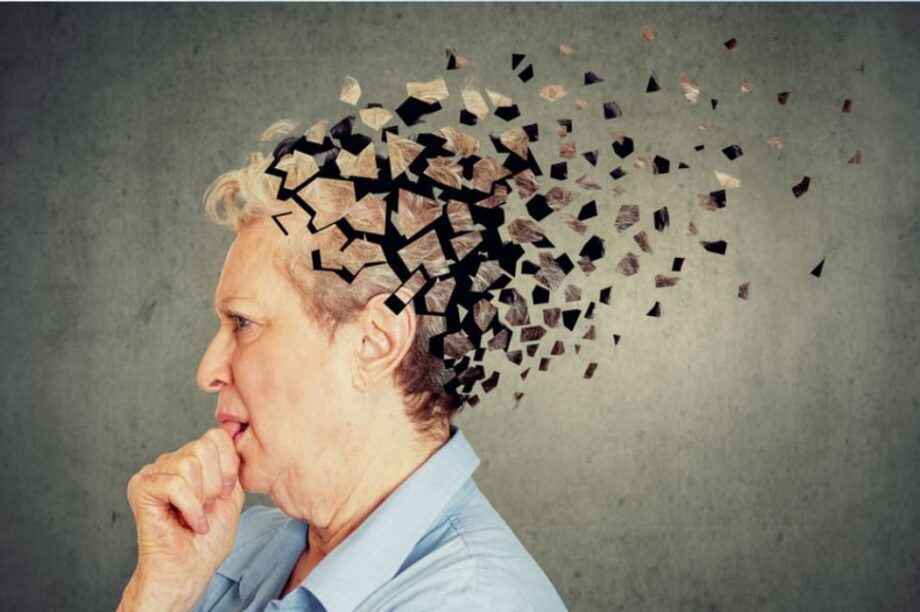 Αλτσχάιμερ