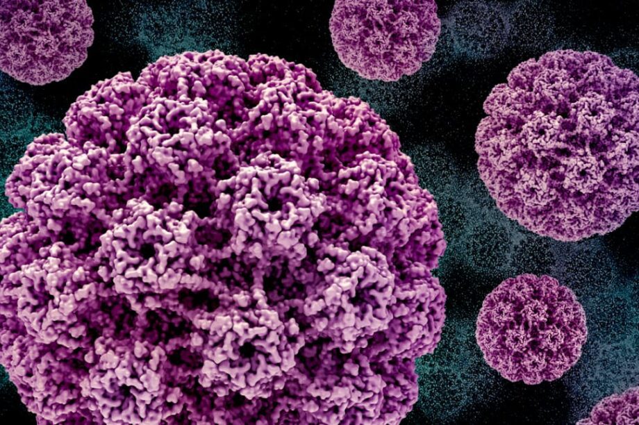 κονδυλώματα