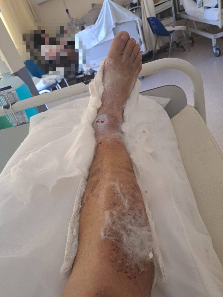 λακκούβα καταγγελία 
