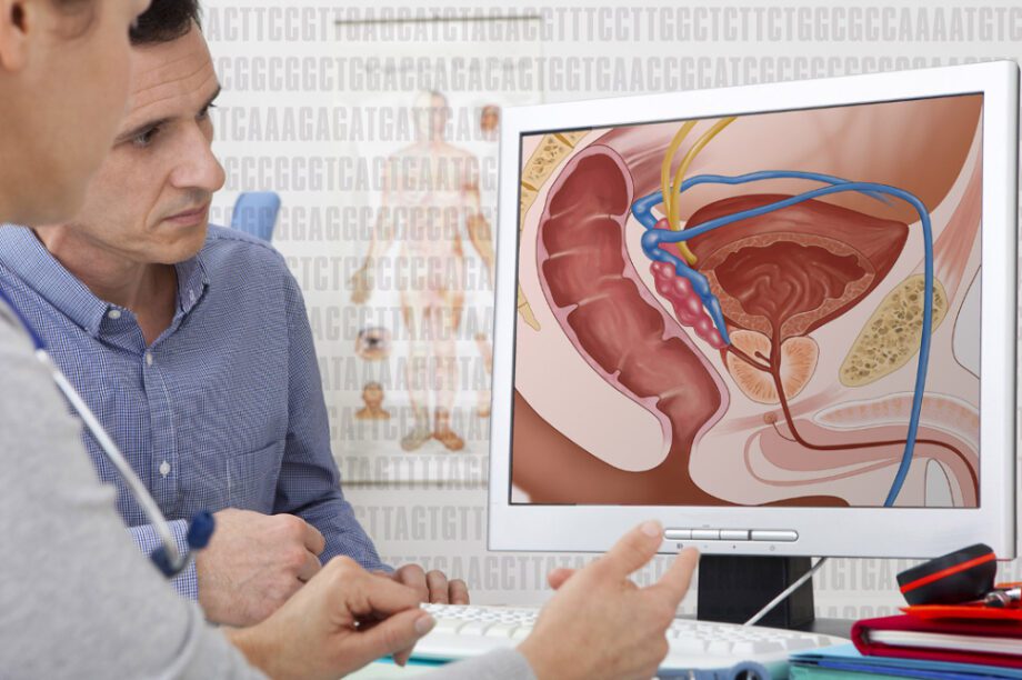 καρκίνος του προστάτη