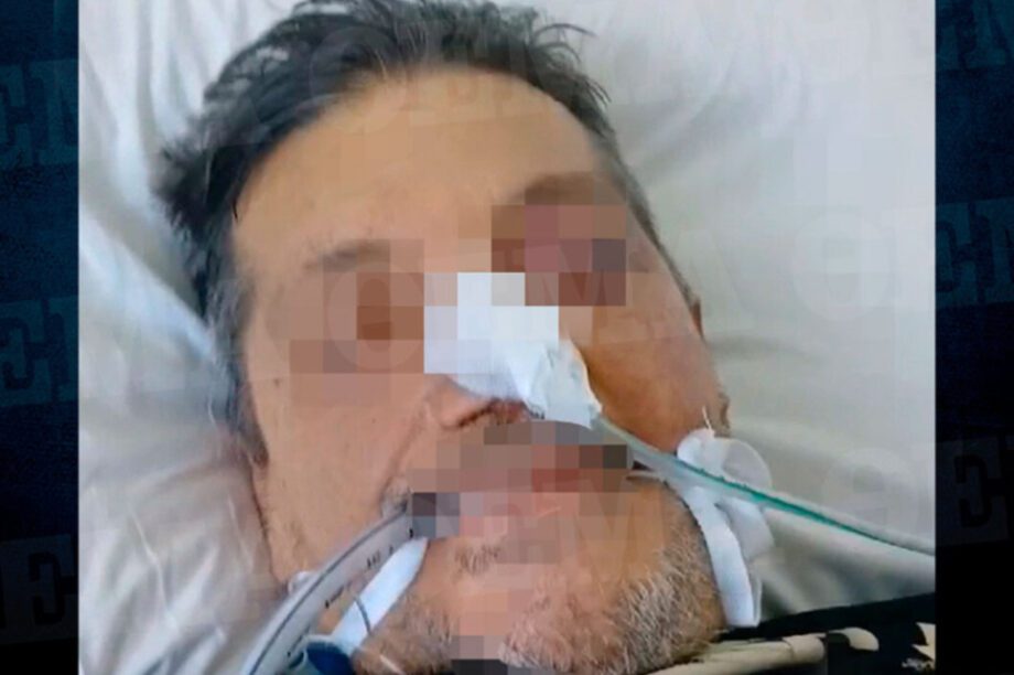 54χρονος Αγρίνιο