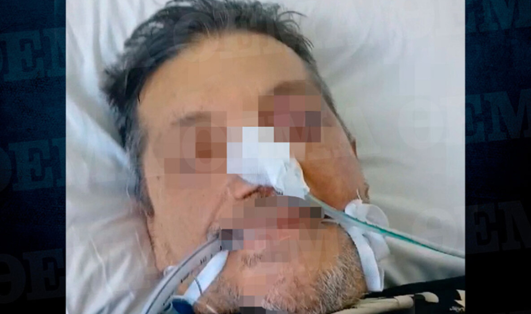 54χρονος Αγρίνιο