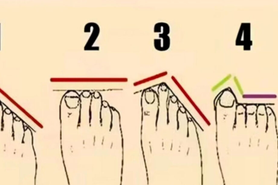 Σχήμα ποδιού