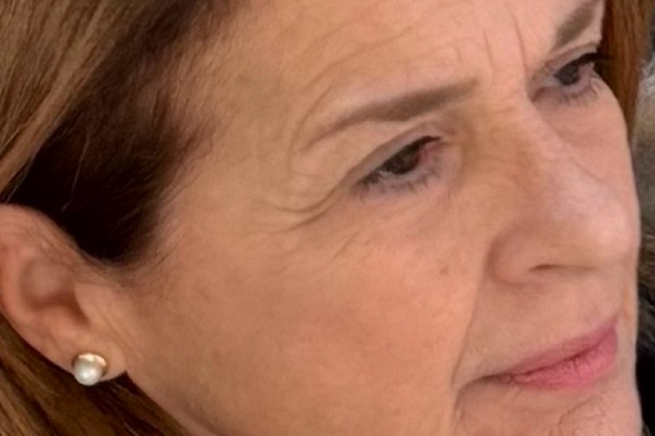 επεμβάσεις Πέγκυ Σταθακοπούλου