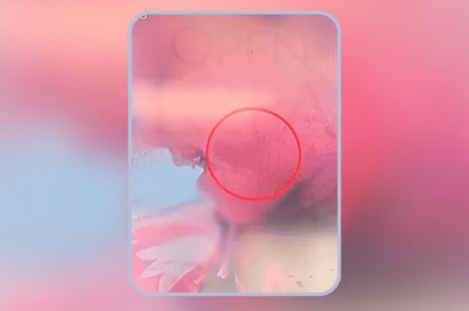 κακοποίηση 3χρονο