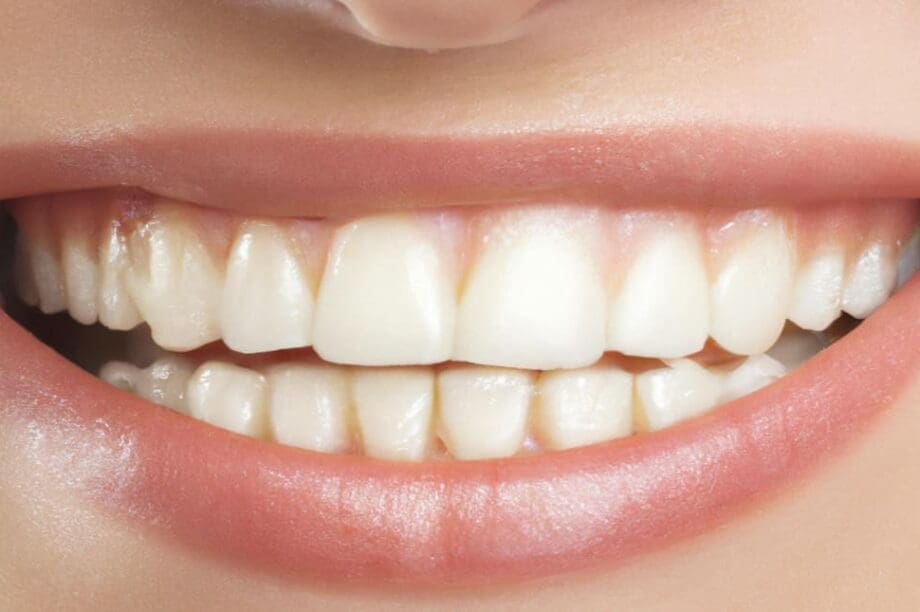 Δόντια χαμόγελο