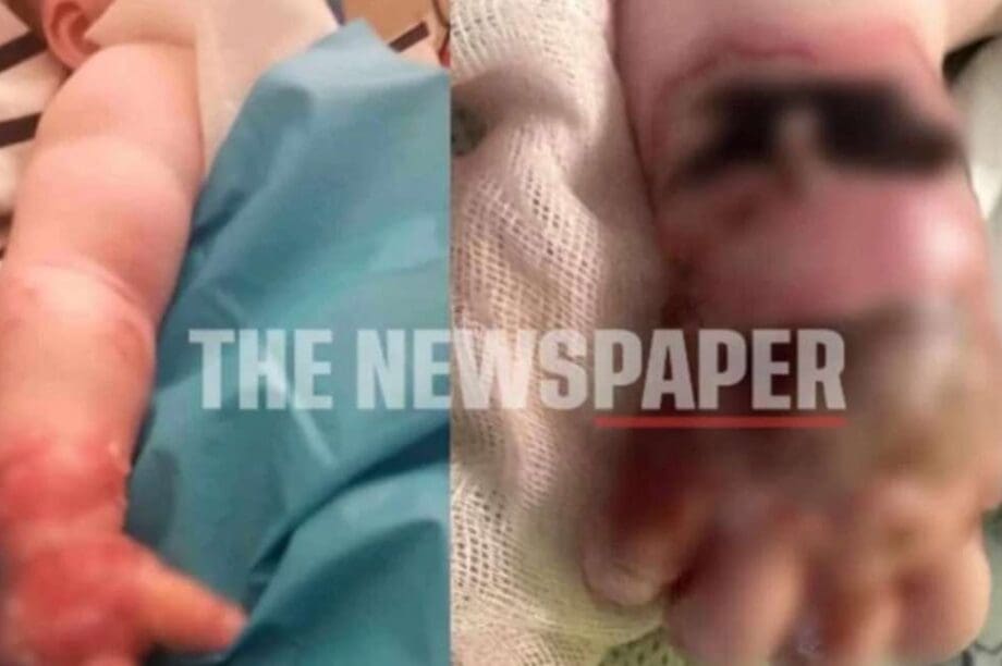 Βόλος βρέφος