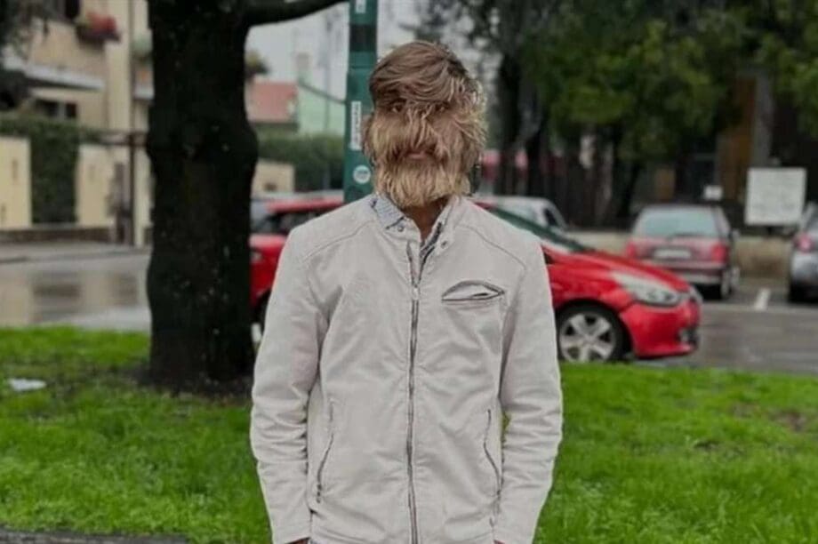 τριχωτός άνθρωπος