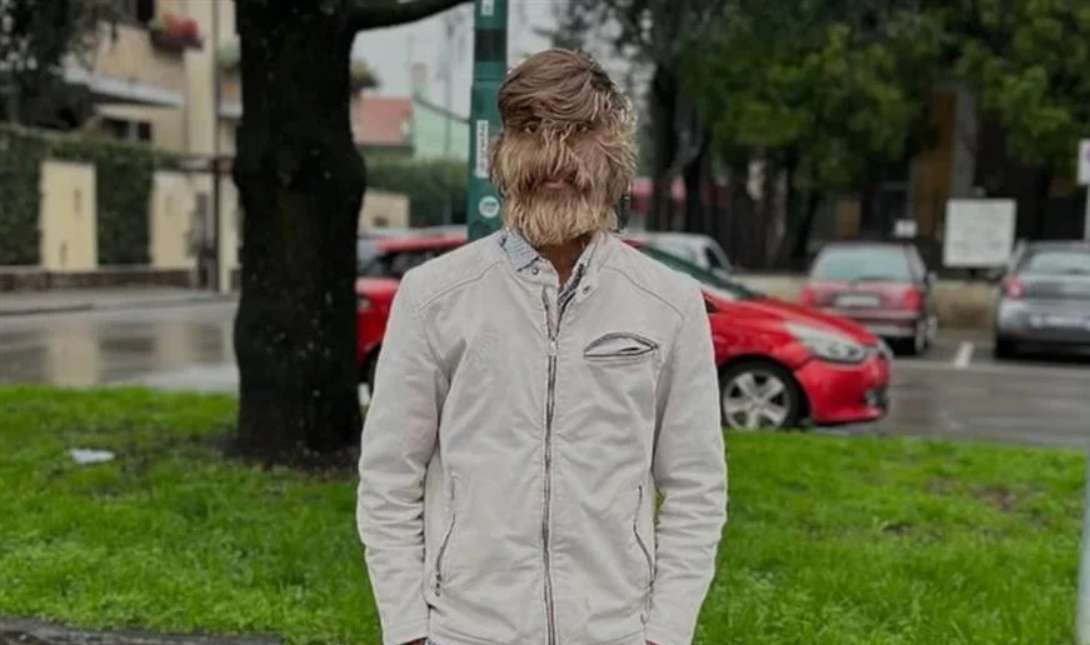τριχωτός άνθρωπος