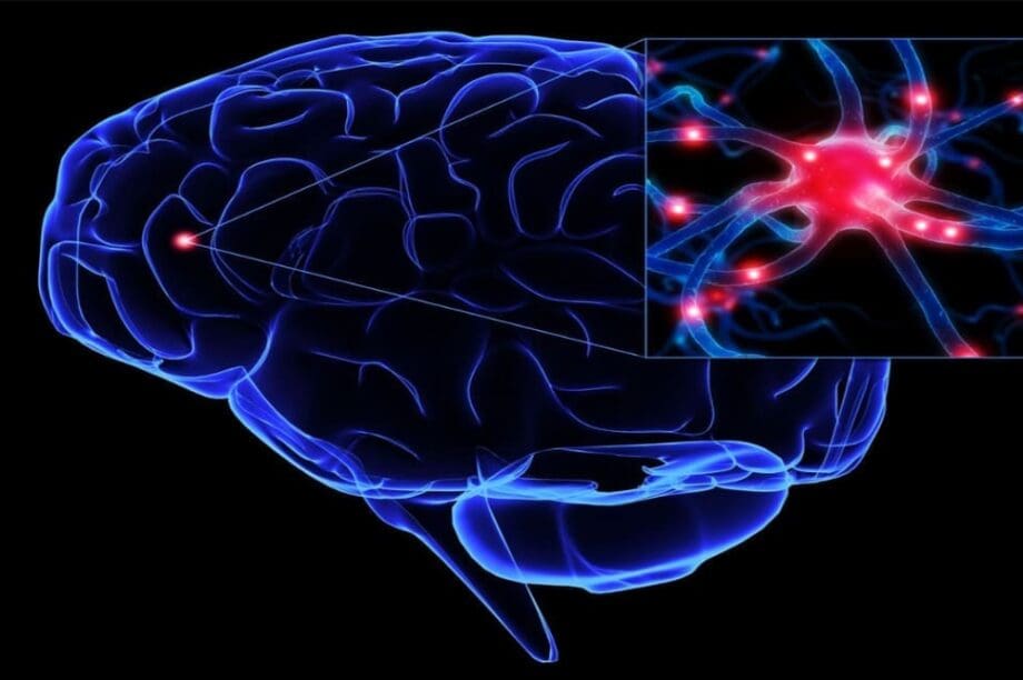 αφασία εγκέφαλος-γεωμετρία