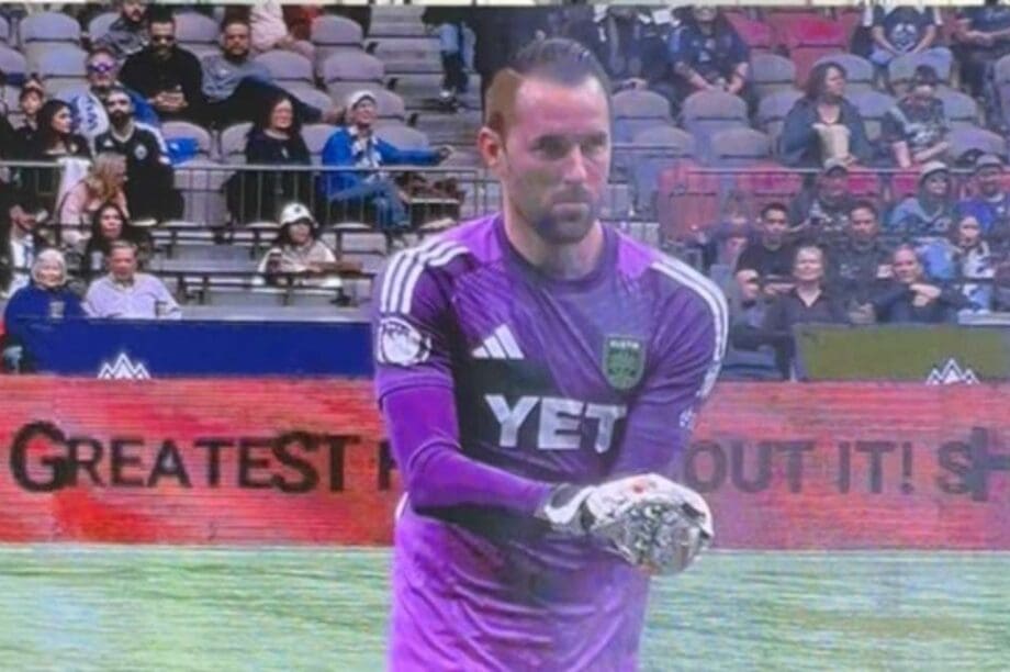 ποντίκι Βανκούβερ