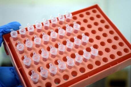 Δότης σπέρματος καρκινικό γονίδιο το μετέδωσε σε 10 παιδιά!