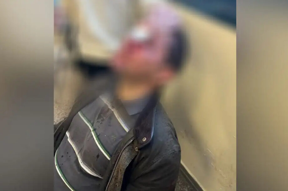 Νομική φοιτητής τραυματισμός