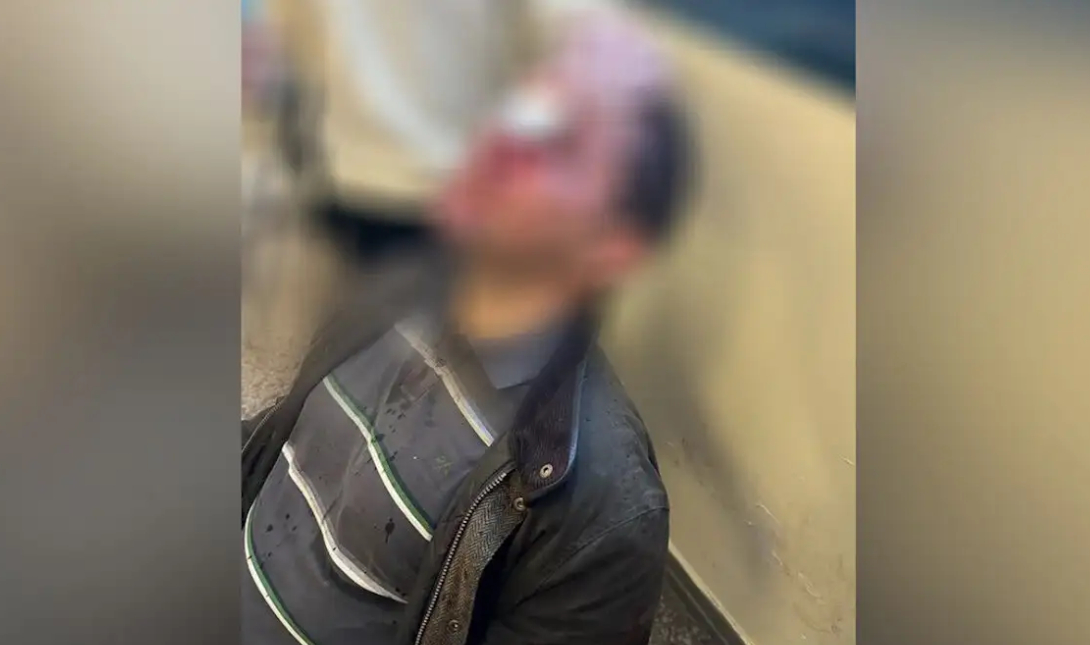 Νομική φοιτητής τραυματισμός