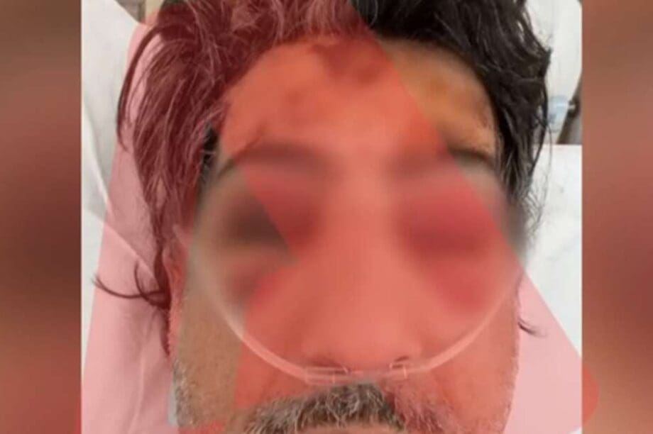 όδηγός επίθεση Άνω Λιόσια