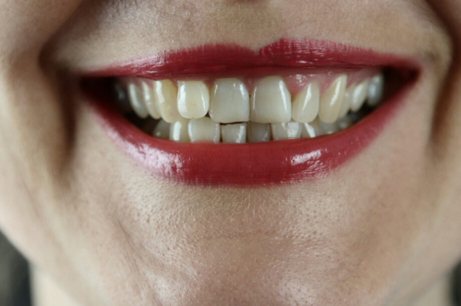 Πώς η επιλογή τροφών επηρεάζει την υγεία των ούλων και την αντοχή των δοντιών